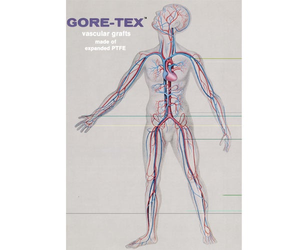 GORE-TEX Vascular Graft